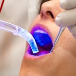 iStock_000001604217XSmall dental laser