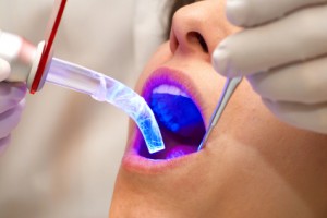 iStock_000001604217XSmall dental laser