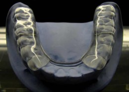 splint
