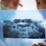 iStock_000011087984XSmall teeth x-ray