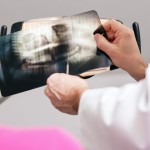 shutterstock_51359269 dentist and patient looking at x-ray