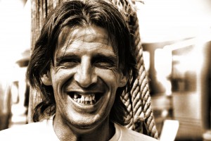shutterstock_3909307 middle aged man with missing teeth