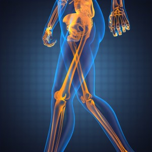 Lower limbs x-ray