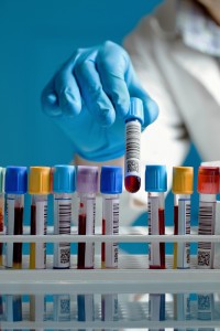 Blood test samples