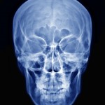 shutterstock_119979133  - PA Skull x-ray