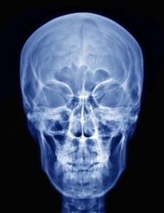 shutterstock_119979133  - PA Skull x-ray