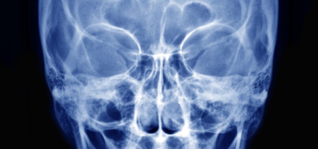 shutterstock_119979133  - PA Skull x-ray