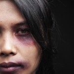 Bruised woman's face