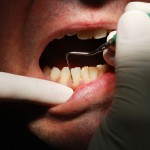 dental_shutterstock_57647551-150x150