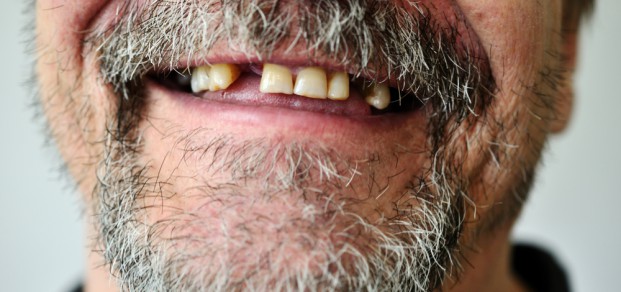 Authors reviewed studies that assessed oral health of people with severe mental illness.
