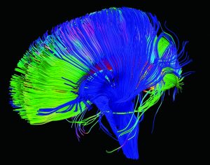 We're beginning to understand how genetic risk factors relate to the different pathways and functions of brain cells.