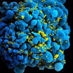 hiv-infected_t_cell_6813384933