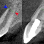 By Drs. Ken Hargreaves and Obadah Austah, Dept of Endodontics, University of Texas Health Science Center at San Antonio - Ken Hargreaves, CC BY 3.0 us, https://commons.wikimedia.org/w/index.php?curid=30784169