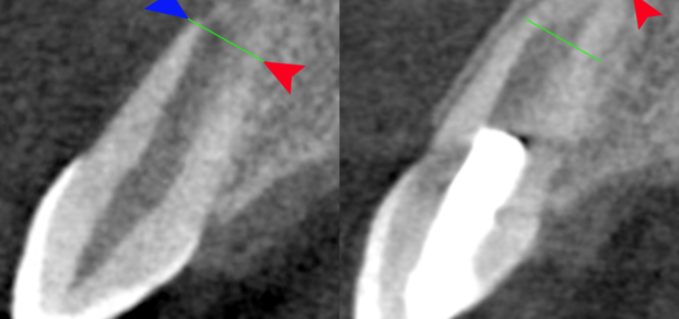 By Drs. Ken Hargreaves and Obadah Austah, Dept of Endodontics, University of Texas Health Science Center at San Antonio - Ken Hargreaves, CC BY 3.0 us, https://commons.wikimedia.org/w/index.php?curid=30784169