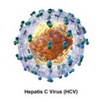 HCV