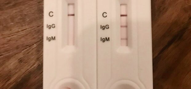 IgGIgM-Covid19-Test