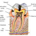 tooth diagramme, caries