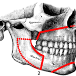 Orthognatic_surgery