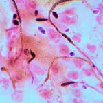 Candida_Gram_stain