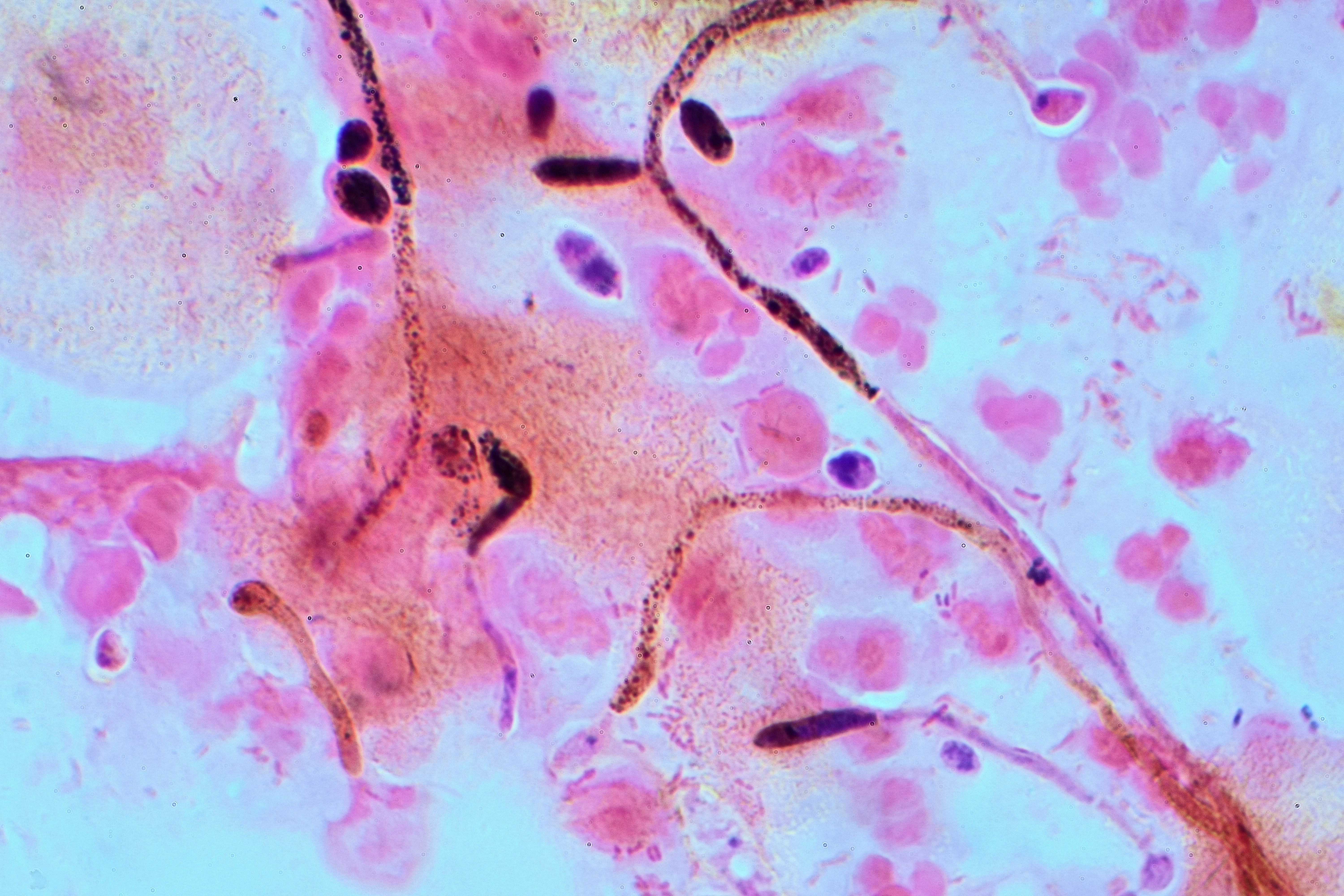 Споры candida. Кандида альбиканс под микроскопом. Грибы кандида под микроскопом. Кандида альбиканс гистология.