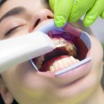 Orthodontic, Scanner