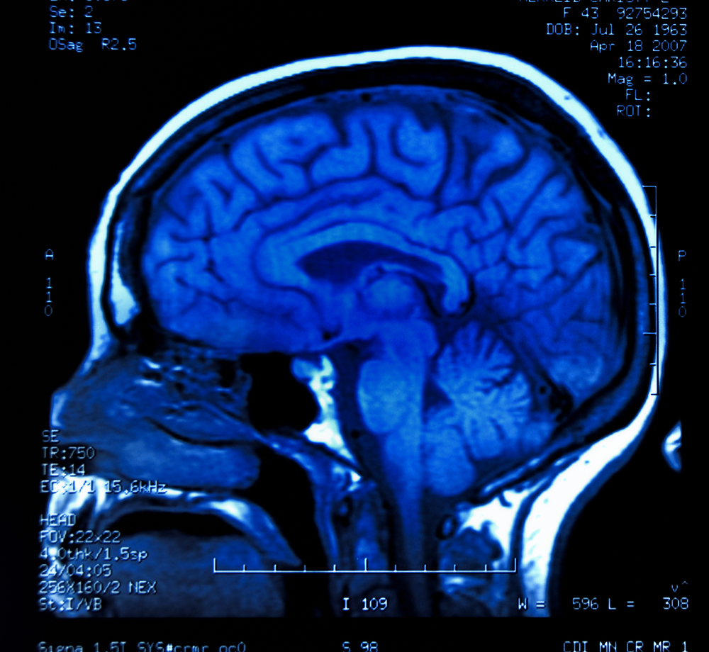 An image of a brain