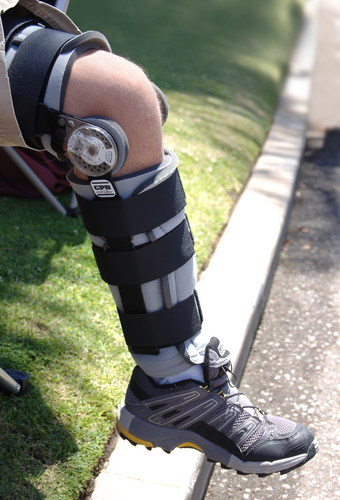 Braces and orthoses for treating osteoarthritis of the knee