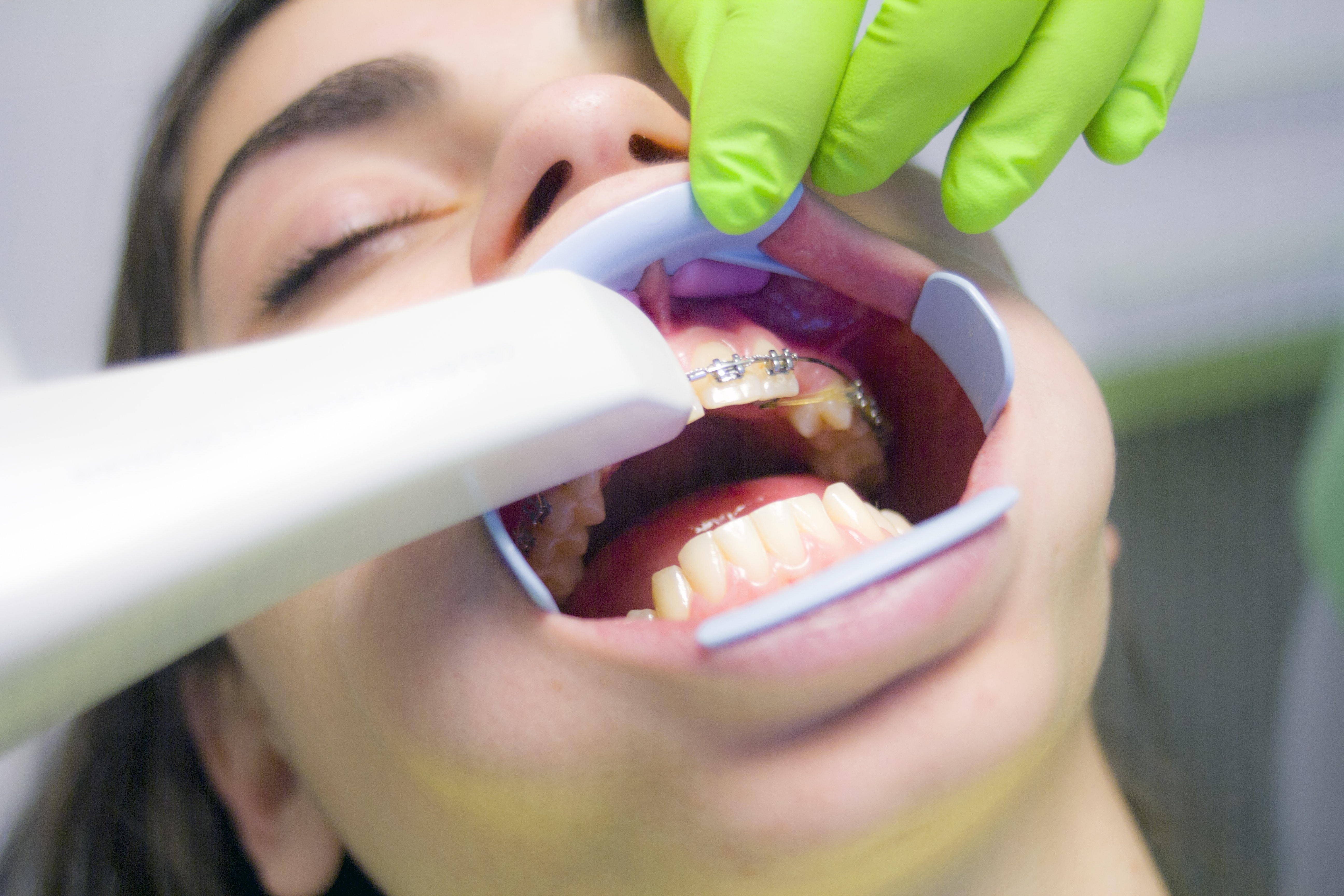 orthodontic