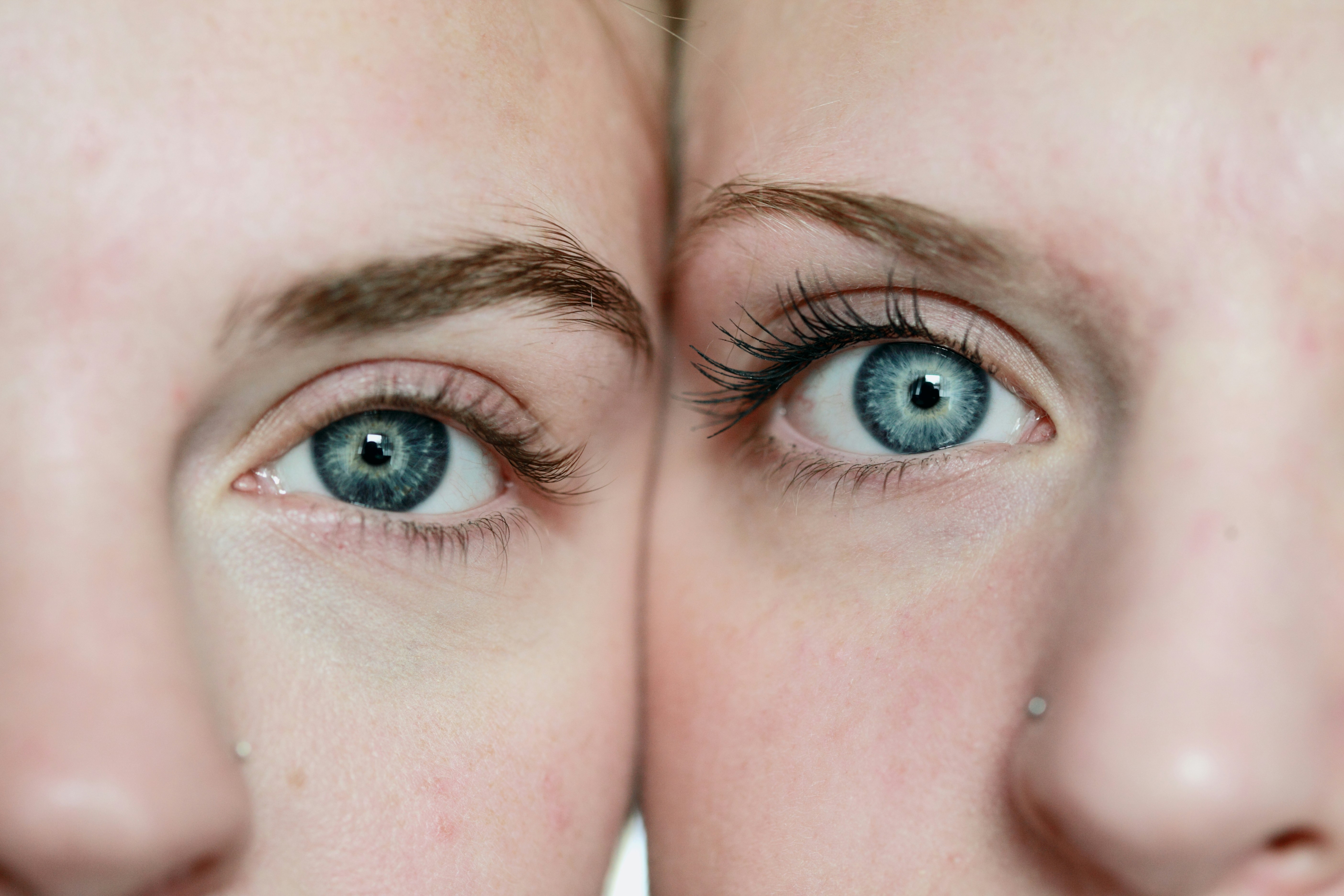 Within-twin analyses supported the causal effects of body dissatisfaction during adolescence on eating disorder and depressive symptoms in young adulthood.